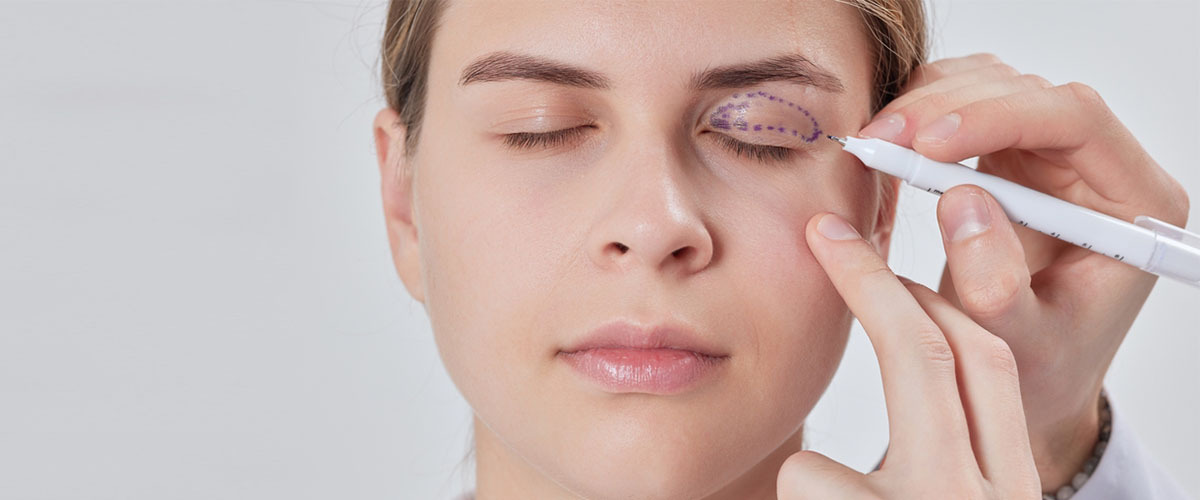 Üst Göz Kapağı Ameliyatı: Kimler İçin Uygun? Kimler Dikkat Etmeli?